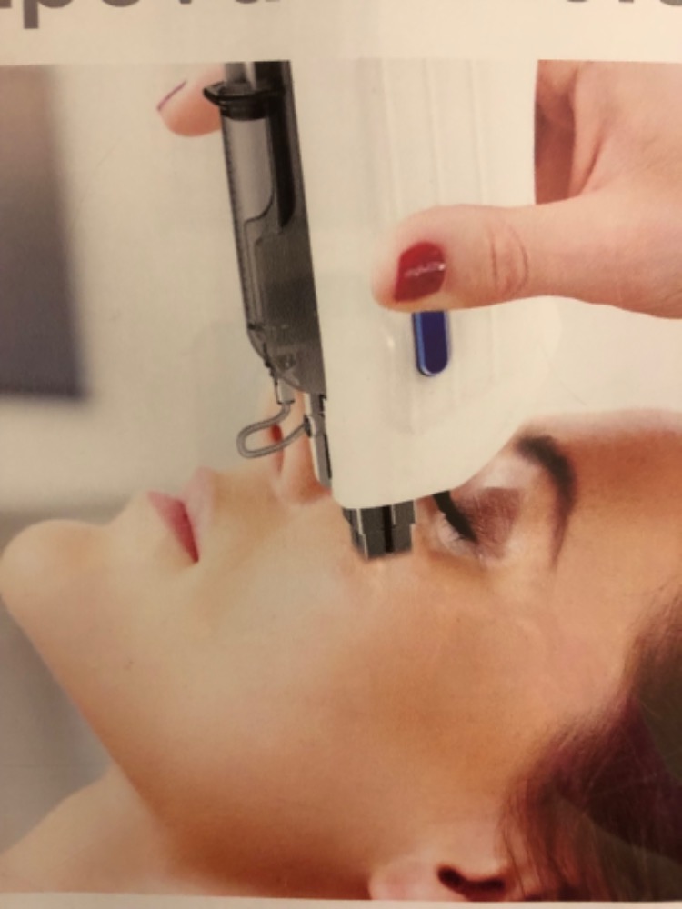 LIFTING S DERMAPAREM